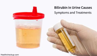 What Bilirubin in Urine Means: Causes, Symptoms